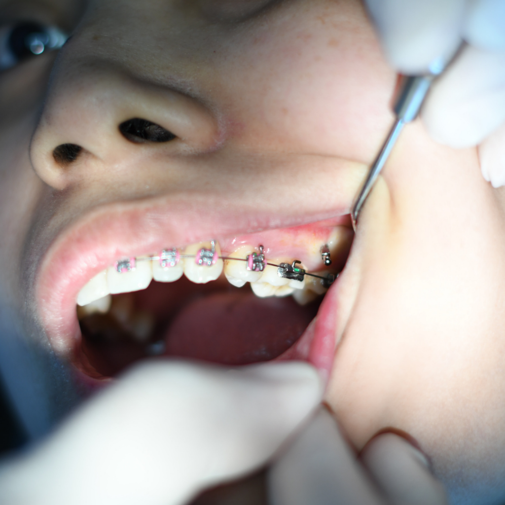 dr tony weir orthodontist brisbane